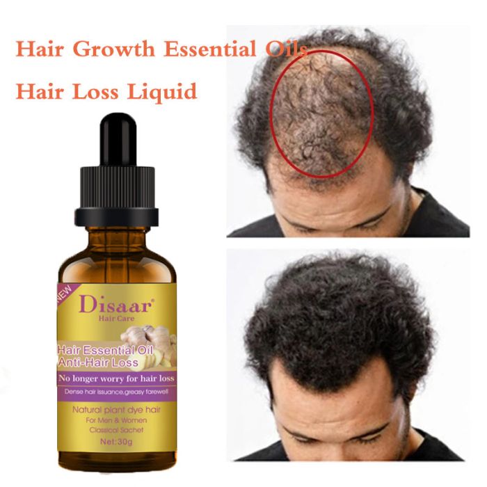 Essence for hair growth GINGER Disaar Hair Essential Oil Anti Hair Loss 30ml