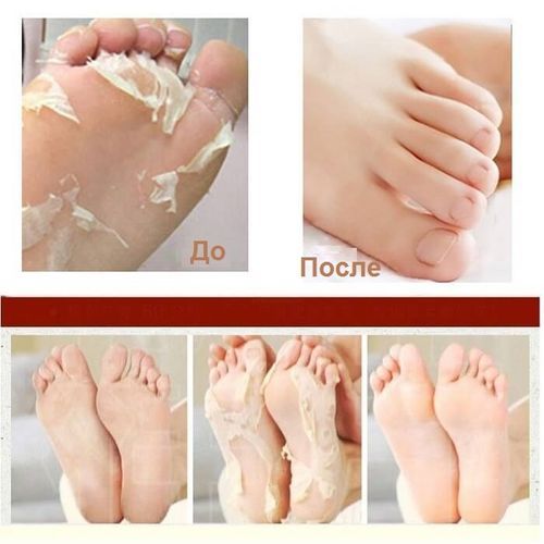 Peeling socks for pedicure with rose scent Sosu Rose Foot Peeling Pack Perorin (2 pairs)