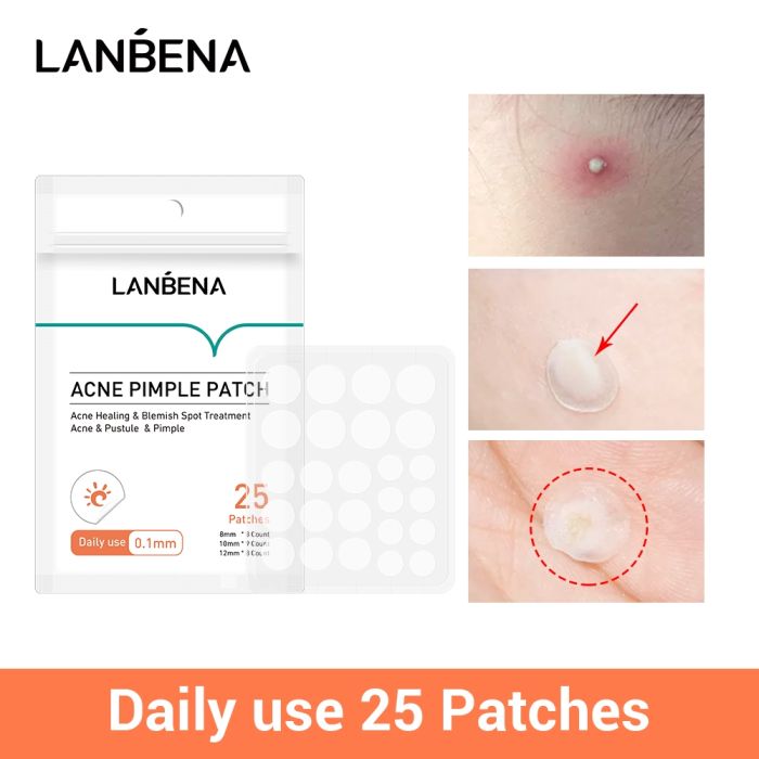 Lanbena Acne Pimple Patch Anti-Inflammatory Patches