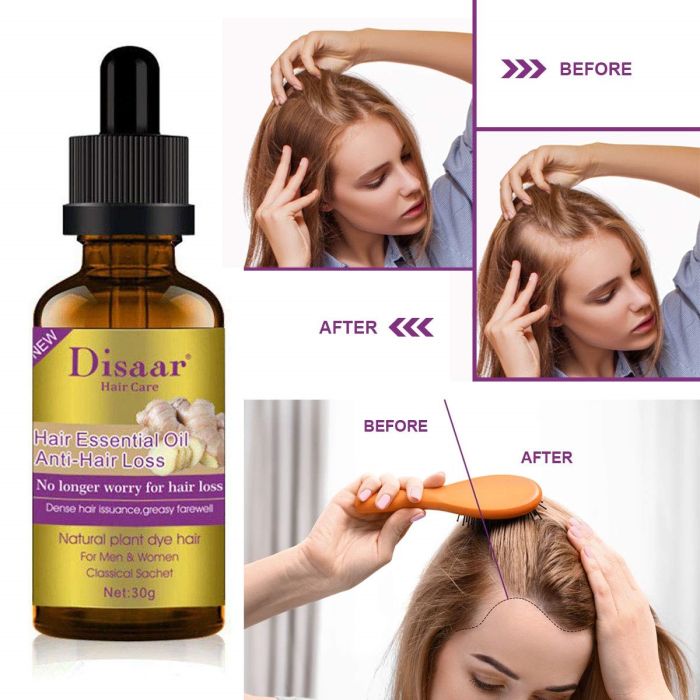 Essence for hair growth GINGER Disaar Hair Essential Oil Anti Hair Loss 30ml